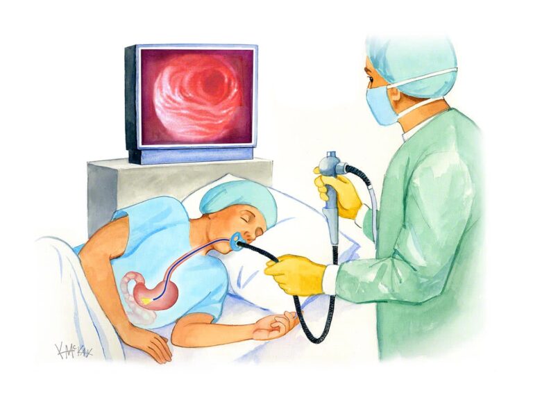 Gastroscopy